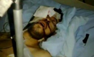 A man shot by Syrian security forces in Homs.