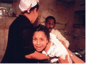 female genital mutilation
