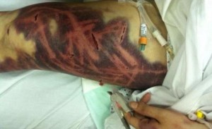 Twenty-six-year old Fatima al-Shehri was subjected to abuse for 11 hours by her husband in Saudi Arabia.