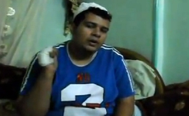 An Egyptian man was attacked his tongue nearly cut off. Al Arabiya